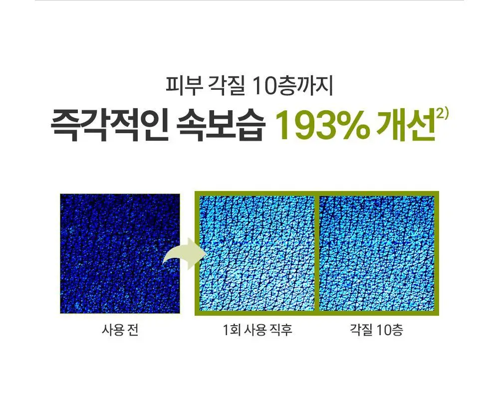제로이드 인텐시브 오인트 크림 80ml 상세페이지 30