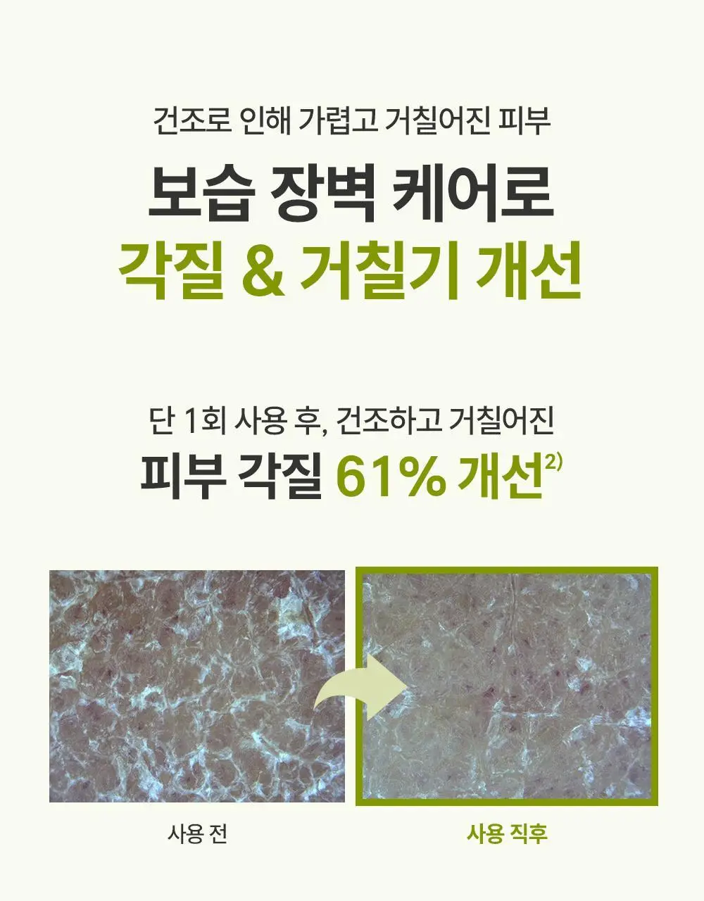 제로이드 인텐시브 오인트 크림 80ml 상세페이지 32