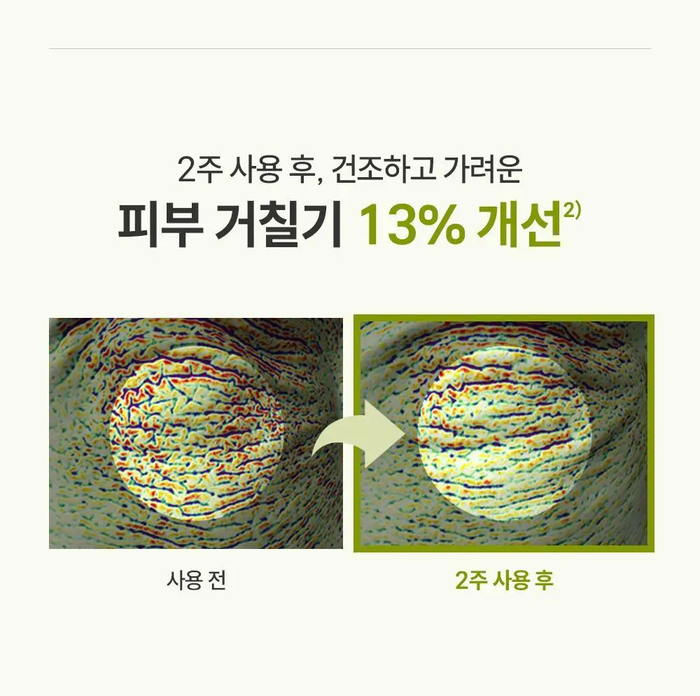 제로이드 인텐시브 오인트 크림 80ml 상세페이지 33