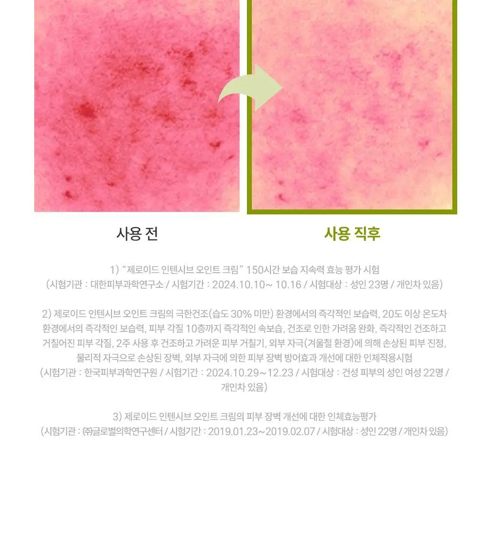 제로이드 인텐시브 오인트 크림 80ml 상세페이지 35