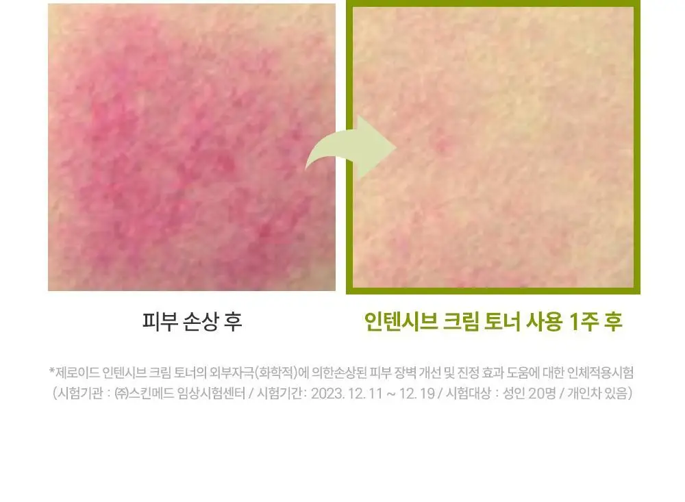 제로이드 인텐시브 크림 토너 200ml 기획 (+크림 10ml) 상세페이지 27