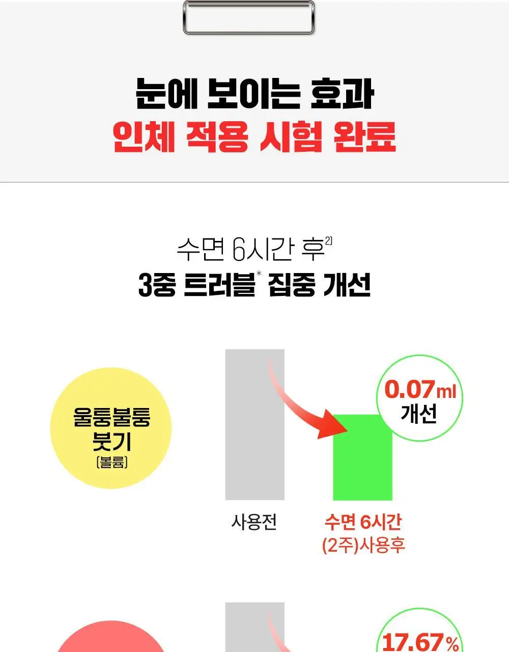 파티온 노스카나인 트러블 흔적 리페어 크림 50ml 기획 (+5ml) 상세페이지 7