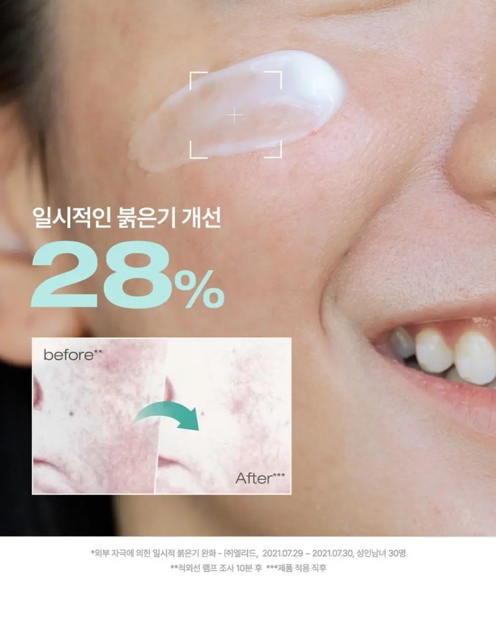 피지오겔 레드수딩 시카밸런스 크림 80ml 대용량 상세페이지 10