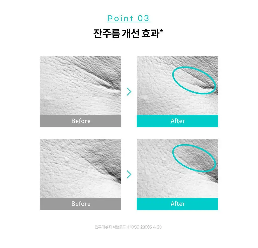 리쥬란 바이옴 힐러 유스포뮬러 앰플 30ml기획 (+더마힐러 앰플1ml*7+더마힐러 크림10g+더마힐러 마스크23ml) 상세페이지 18