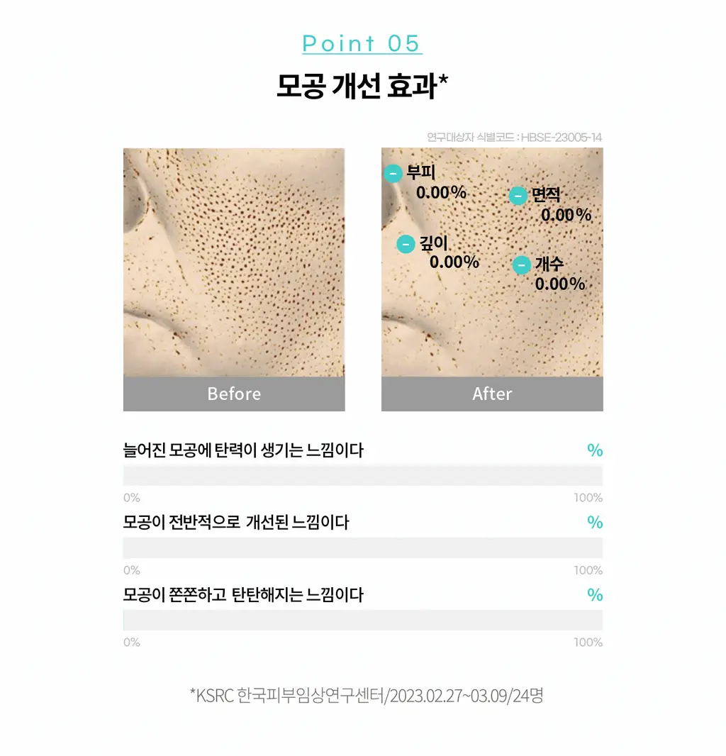 리쥬란 바이옴 힐러 유스포뮬러 앰플 30ml기획 (+더마힐러 앰플1ml*7+더마힐러 크림10g+더마힐러 마스크23ml) 상세페이지 20