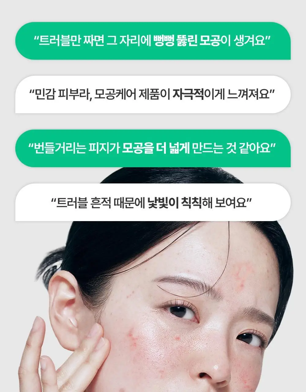 바이오더마 세비엄 세럼 30ml 기획 (+센시비오 H2O 5ml*2) (2604) 상세페이지 5