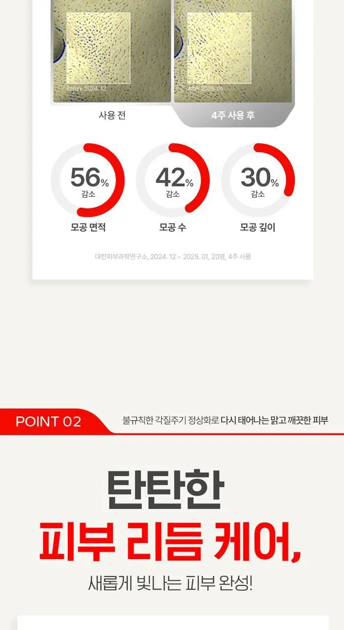 케어놀로지 리본 35% 애씨드 워시오프 필 30ml 상세페이지 12
