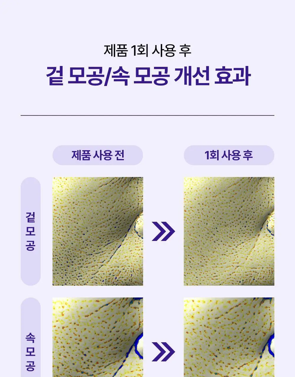 리얼베리어 레티니올 모공 타이트닝 세럼 겔 마스크 30g 상세페이지 11