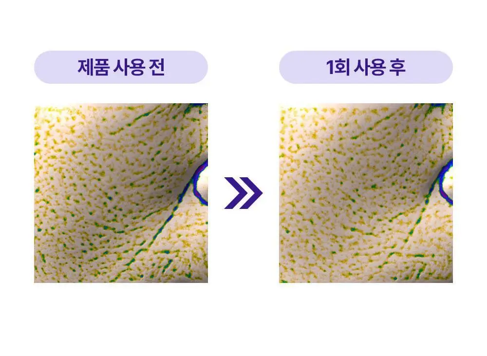 리얼베리어 레티니올 모공 타이트닝 세럼 겔 마스크 30g 상세페이지 15
