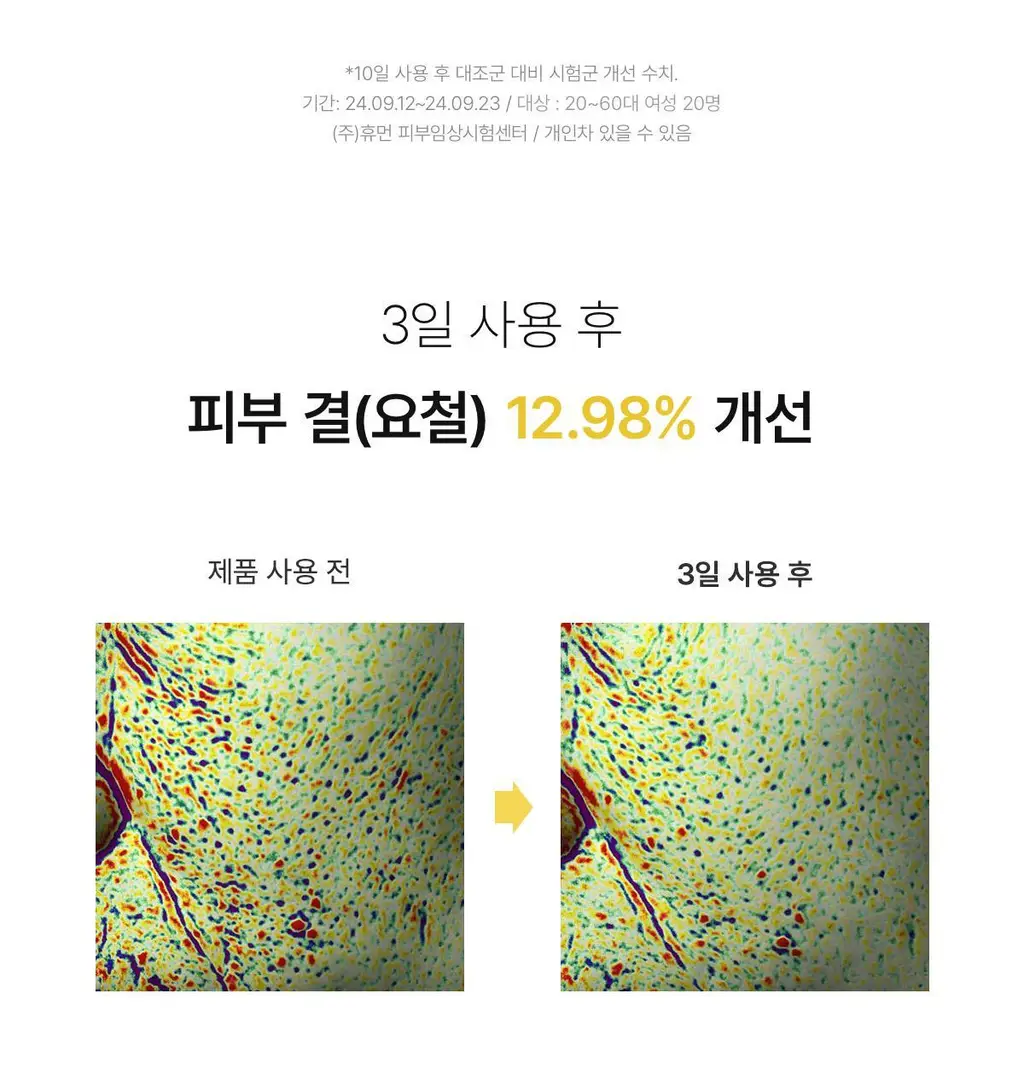 바이오던스 래디언트 비타 나이아신아마이드 리얼 딥 마스크 1매 상세페이지 24