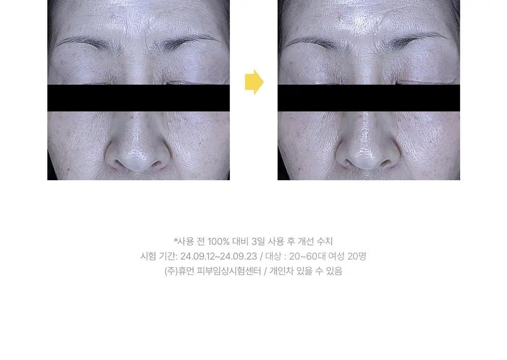 바이오던스 래디언트 비타 나이아신아마이드 리얼 딥 마스크 1매 상세페이지 29