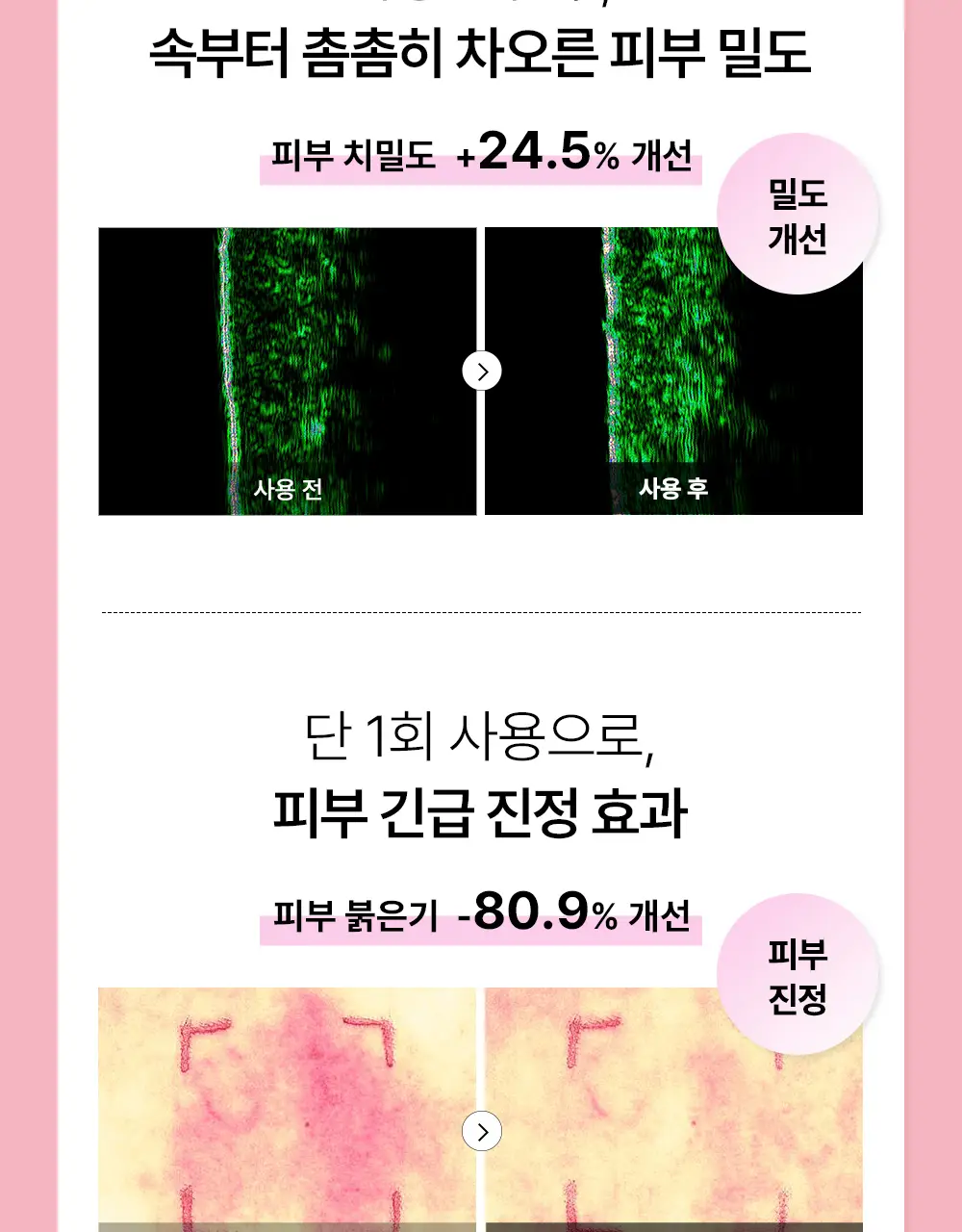 코스알엑스 겔 마스크팩 1매입 3종 중 택 1 (스네일/펩타이드/알파-알부틴) 상세페이지 57