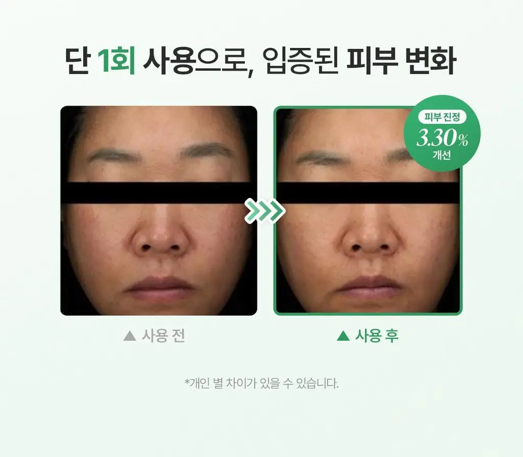 닥터엘시아 쿠션 베일 카밍 마스크 4매 상세페이지 10