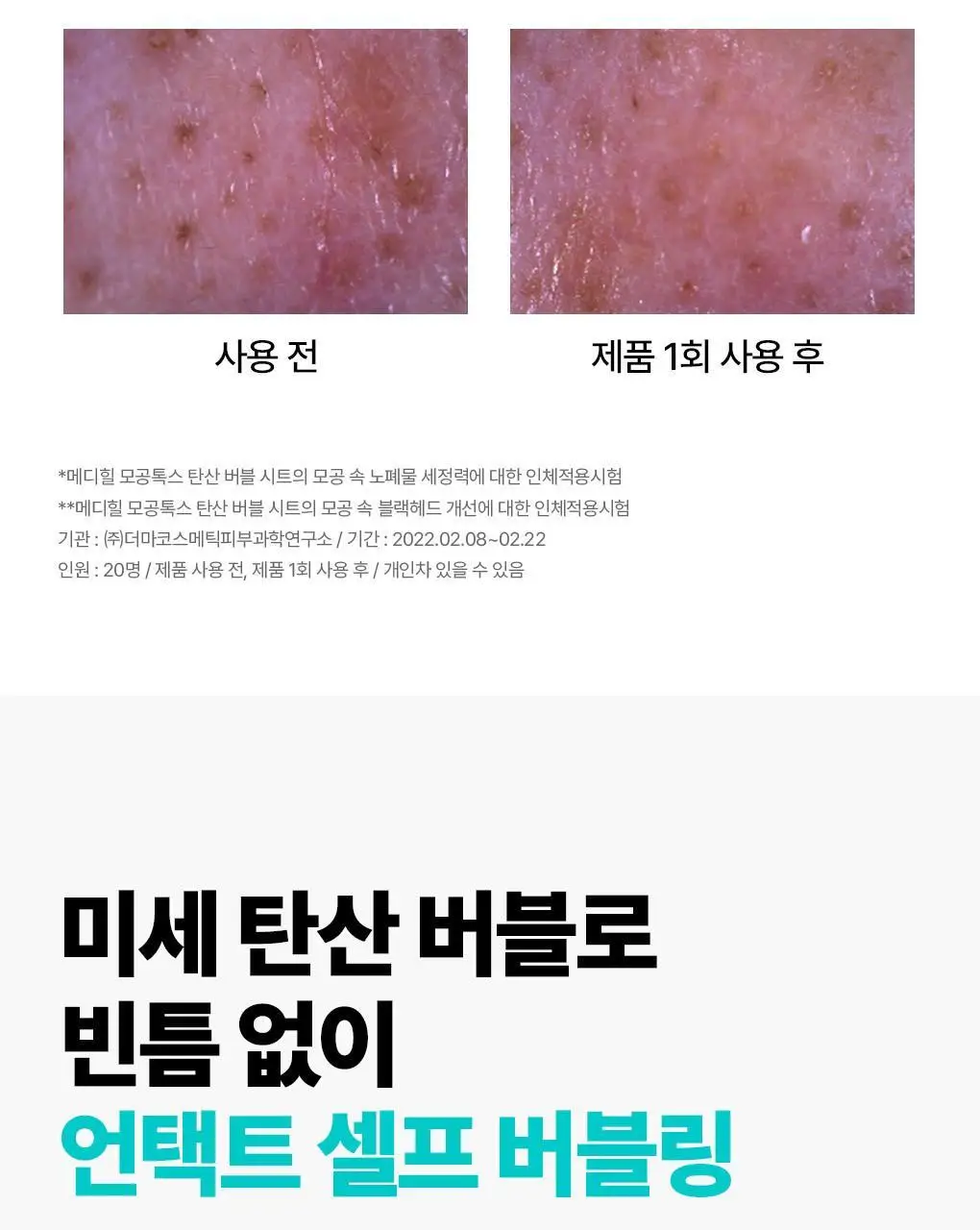 메디힐 모공톡스 탄산 버블 시트 10매 상세페이지 12