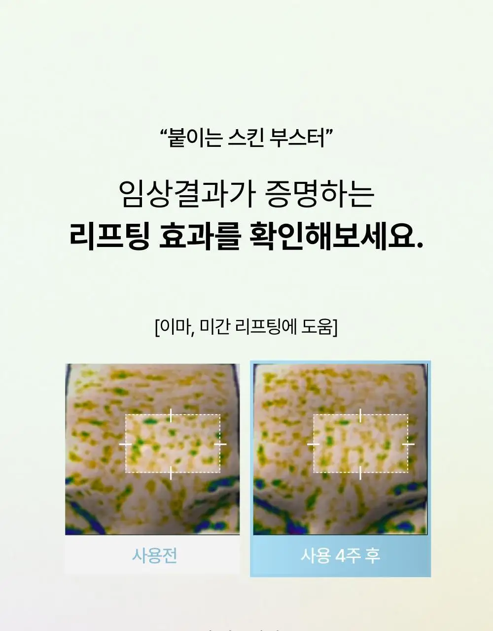 브리스킨 부활초 엑소펩타이드 콜라겐 마스크 1매 상세페이지 7