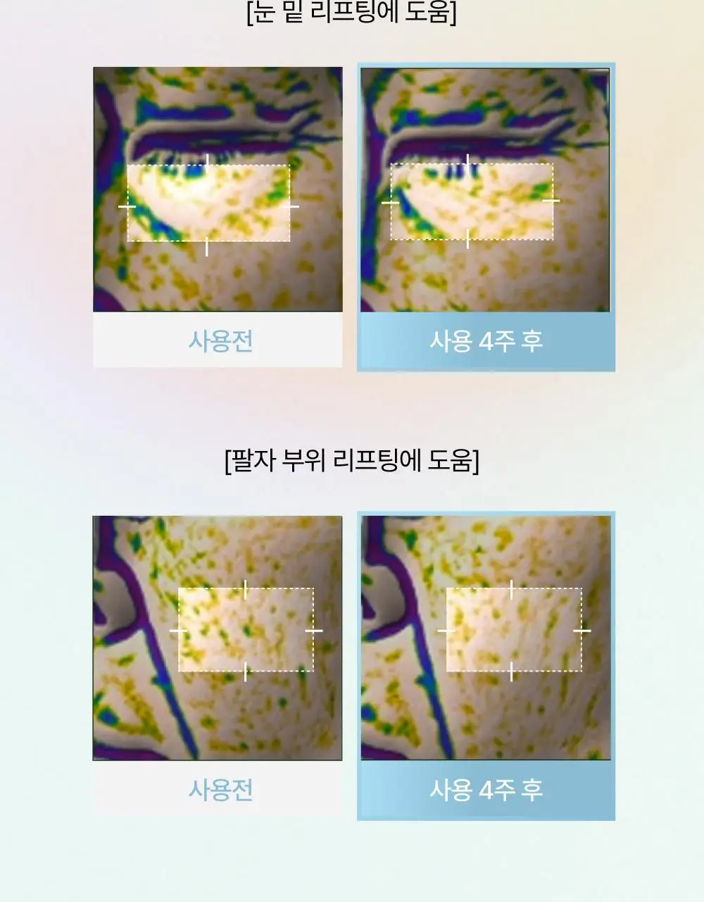 브리스킨 부활초 엑소펩타이드 콜라겐 마스크 1매 상세페이지 8