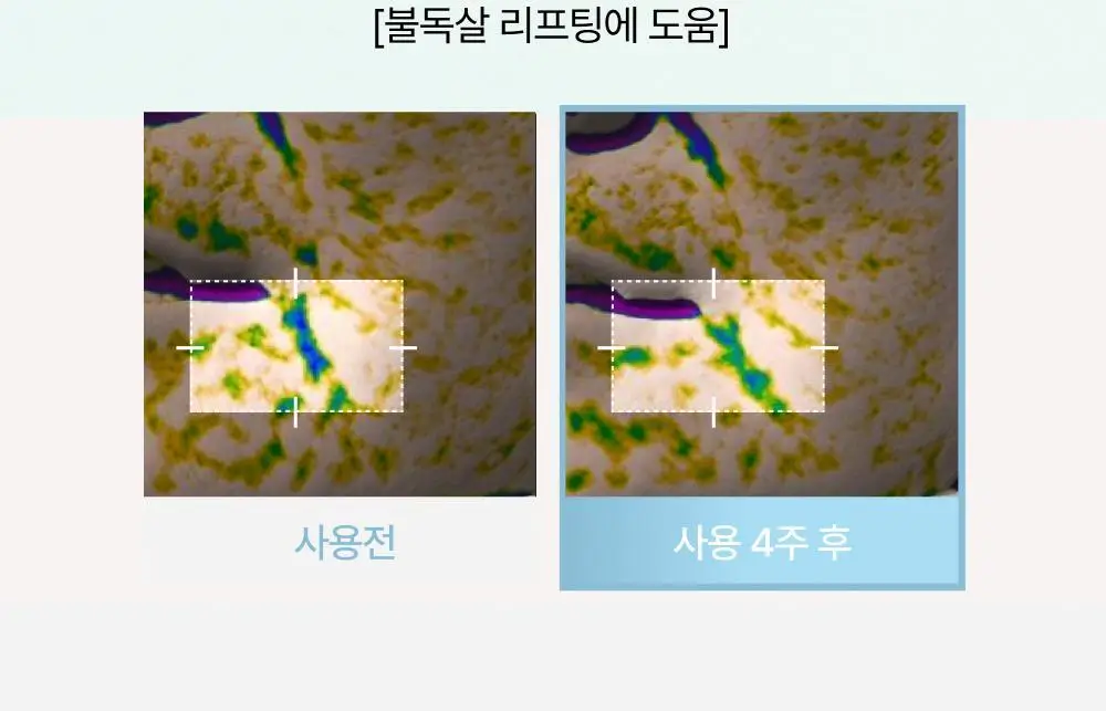 브리스킨 부활초 엑소펩타이드 콜라겐 마스크 1매 상세페이지 9