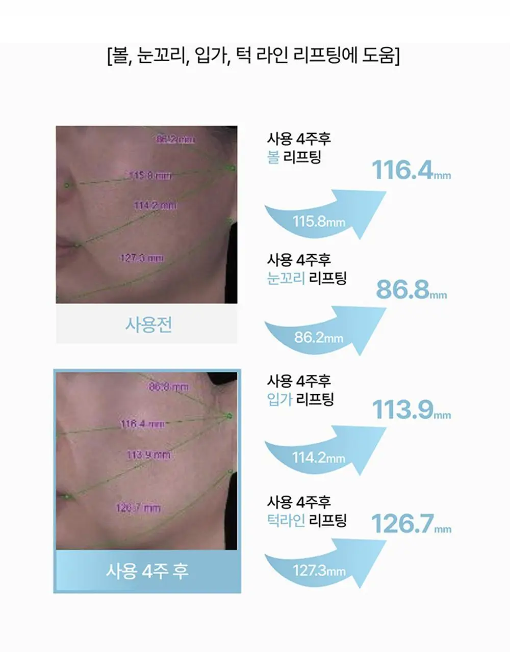 브리스킨 부활초 엑소펩타이드 콜라겐 마스크 1매 상세페이지 27