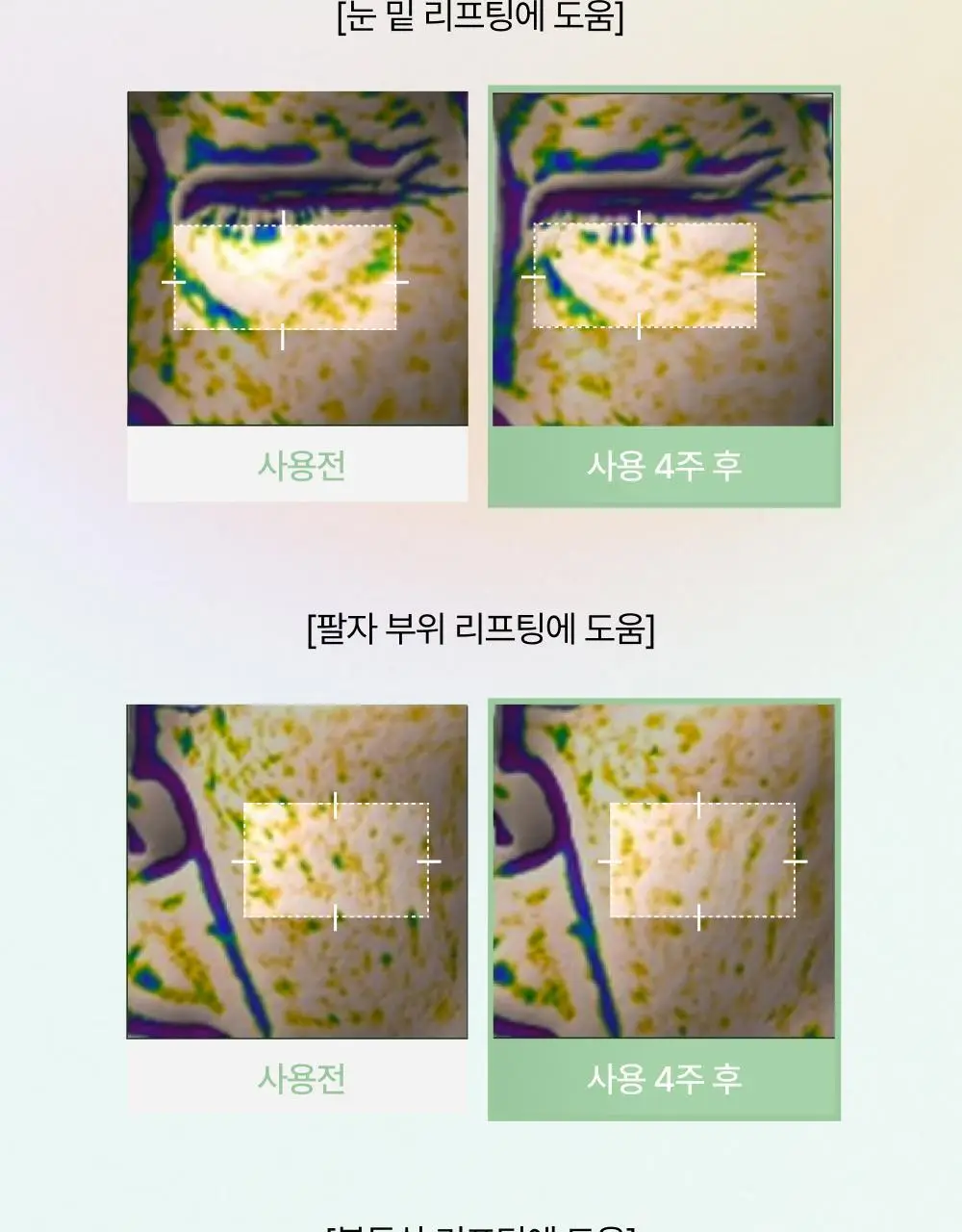 브리스킨 어성초 엑소펩타이드 콜라겐 마스크 1매 상세페이지 8