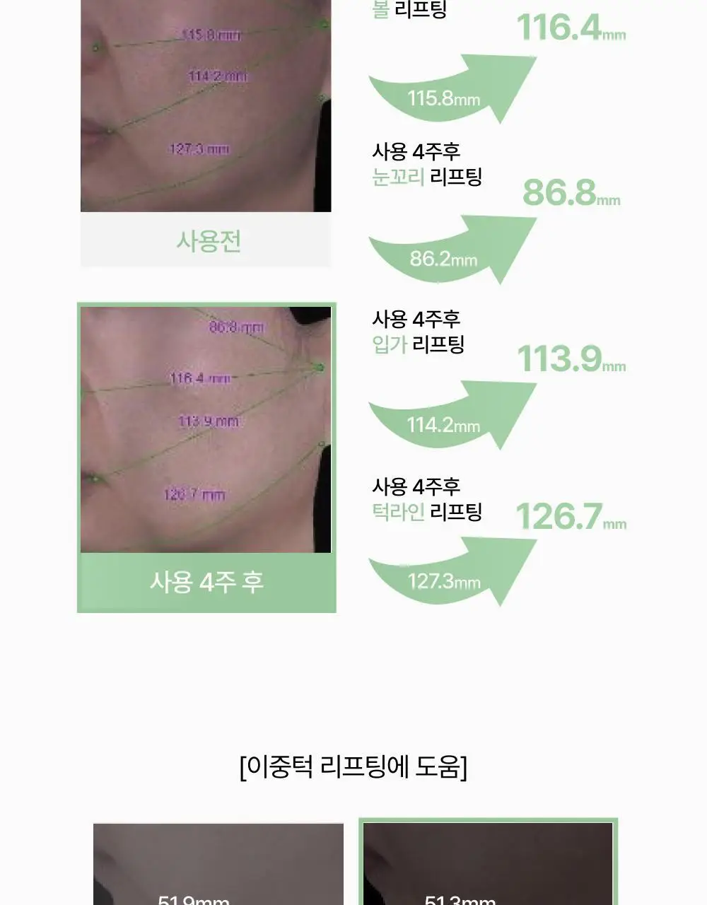 브리스킨 어성초 엑소펩타이드 콜라겐 마스크 1매 상세페이지 26
