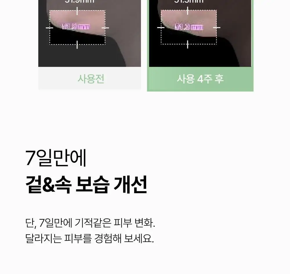 브리스킨 어성초 엑소펩타이드 콜라겐 마스크 1매 상세페이지 27
