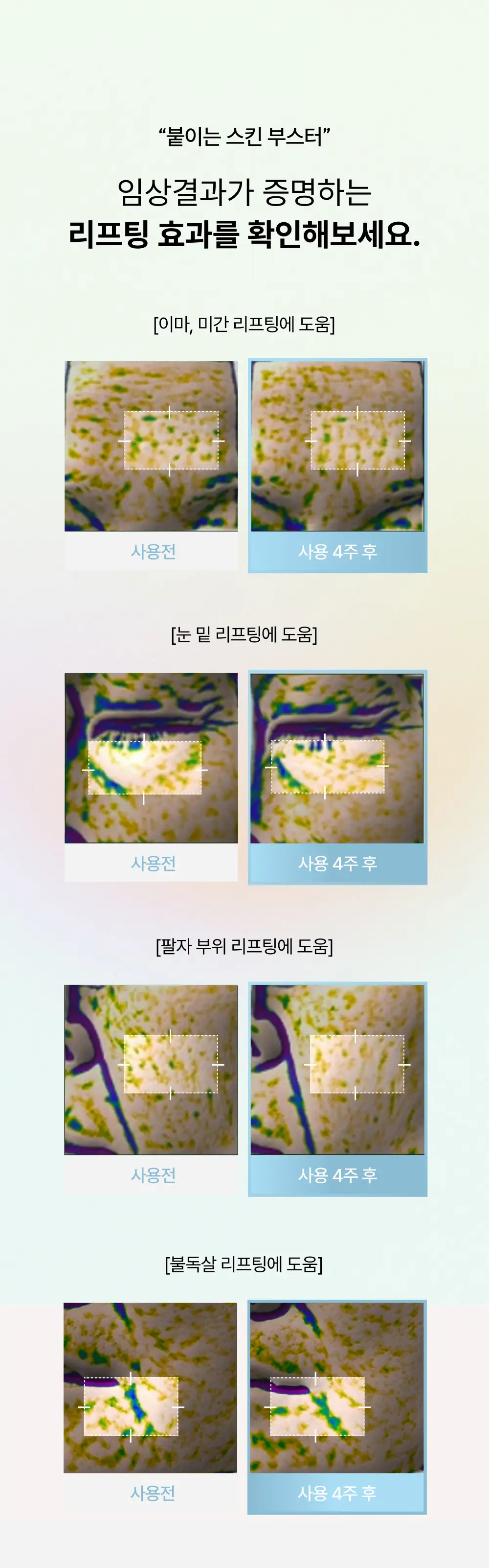 브리스킨 엑소펩타이드 콜라겐 마스크 5매(부활초/어성초) 상세페이지 3