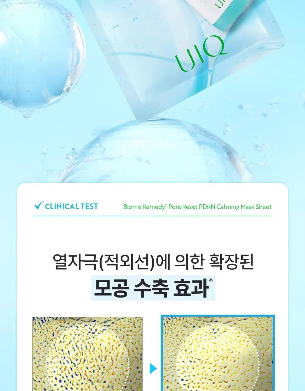 유이크 바이옴 레미디 포어리셋 PDRN 카밍 마스크 시트 5매 상세페이지 21