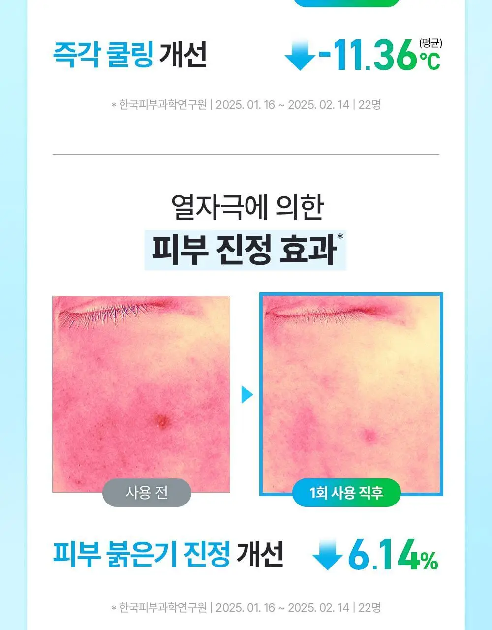 유이크 바이옴 레미디 포어리셋 PDRN 카밍 마스크 시트 5매 상세페이지 23