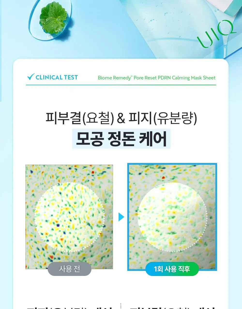 유이크 바이옴 레미디 포어리셋 PDRN 카밍 마스크 시트 5매 상세페이지 26