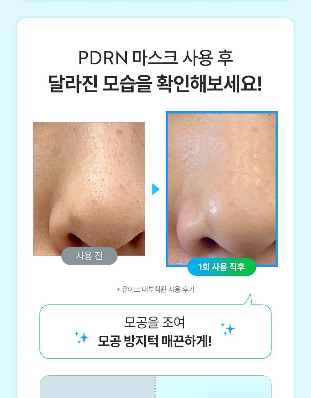 유이크 바이옴 레미디 포어리셋 PDRN 카밍 마스크 시트 5매 상세페이지 28