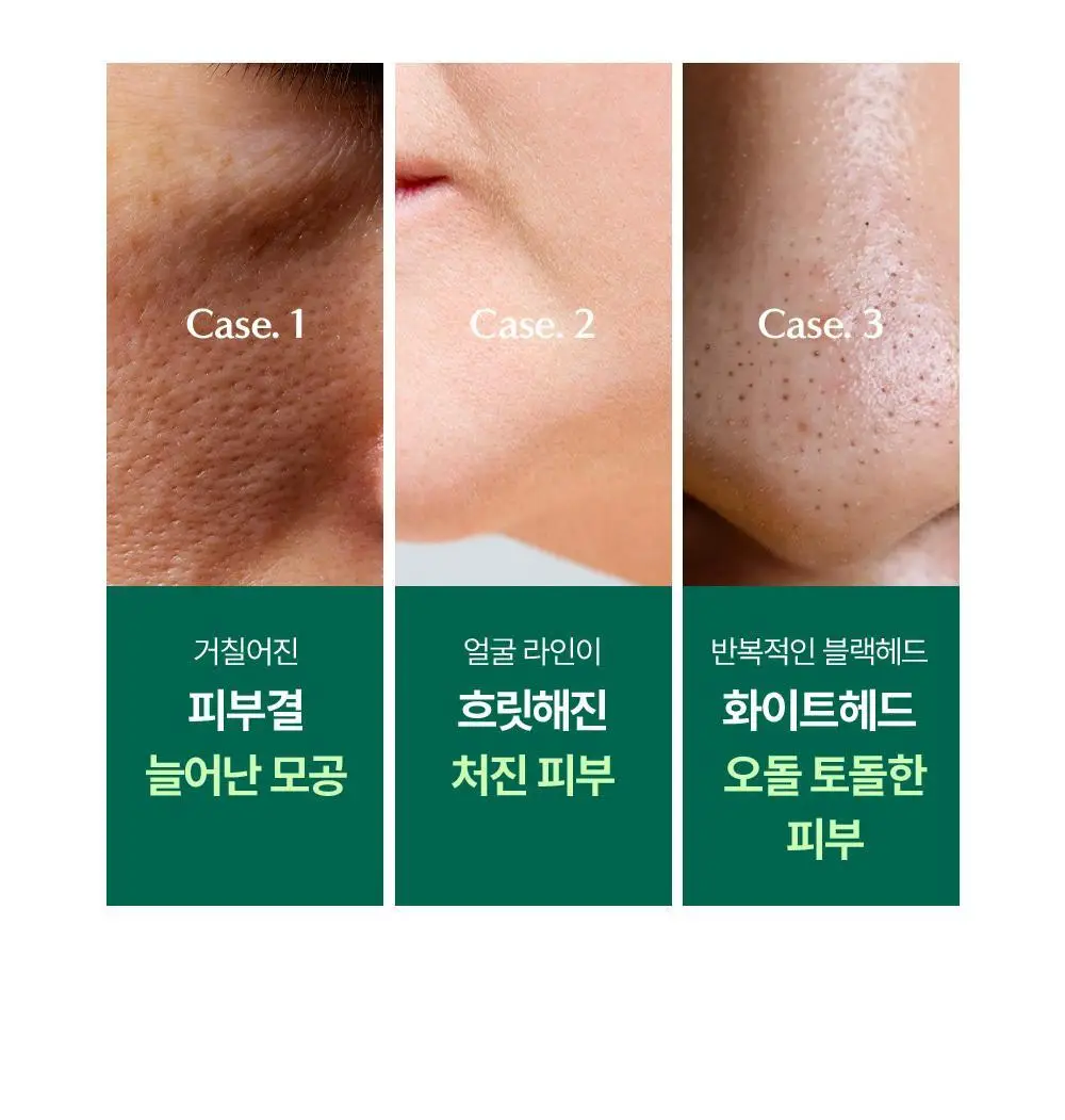콤마나인 포어 타이트 페이셜 클레이 팩 4매 상세페이지 5
