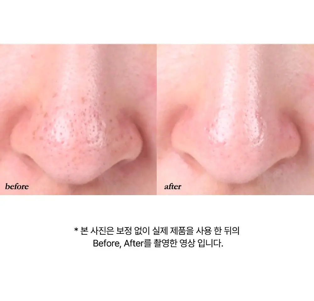 선덕제주 케라바이옴엑스 버블 도트 코팩 7매 상세페이지 53
