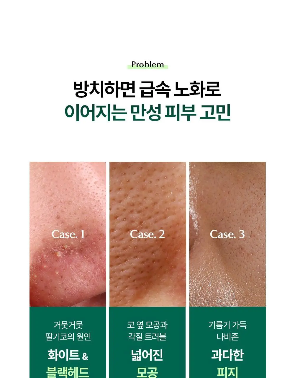 콤마나인 포어 타이트 노즈 클레이 팩 4매 상세페이지 5