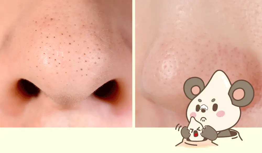 해서린 포어 클리어 티트리 코팩 8매 상세페이지 4