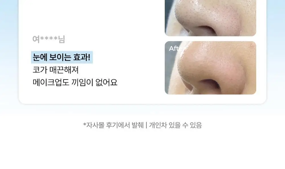 (리뉴얼) 원데이즈유 피지쏙쏙 노모어 블랙헤드 코팩 5매 상세페이지 9