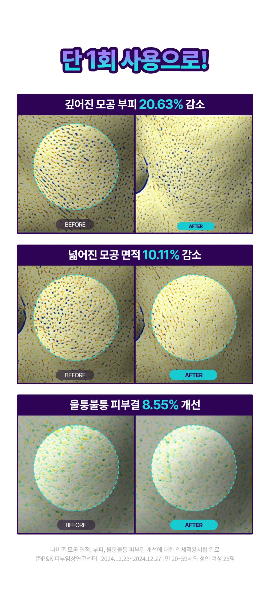 닥터지 바쿠치올 포어젯 스피큘 패드 30매 상세페이지 7