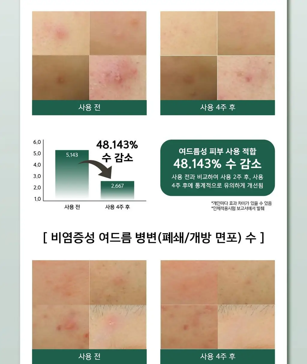 몰바니 아티초크 수딩 아크네 포어 토너 패드 70매 상세페이지 16