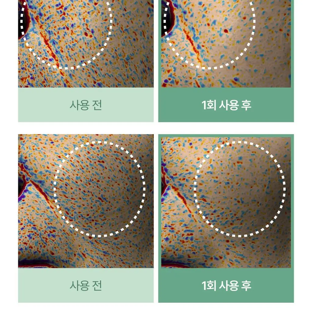 셀리맥스 지우개 시카 바하 블레미쉬 토너 패드 60매 기획 (+60매) 상세페이지 18