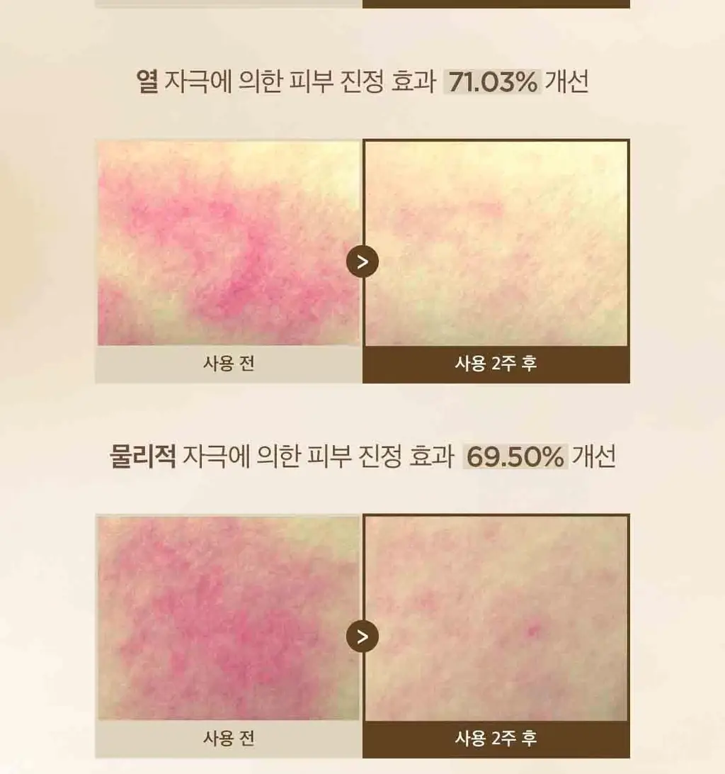스킨1004 마다가스카르 센텔라 퀵카밍 패드 상세페이지 11