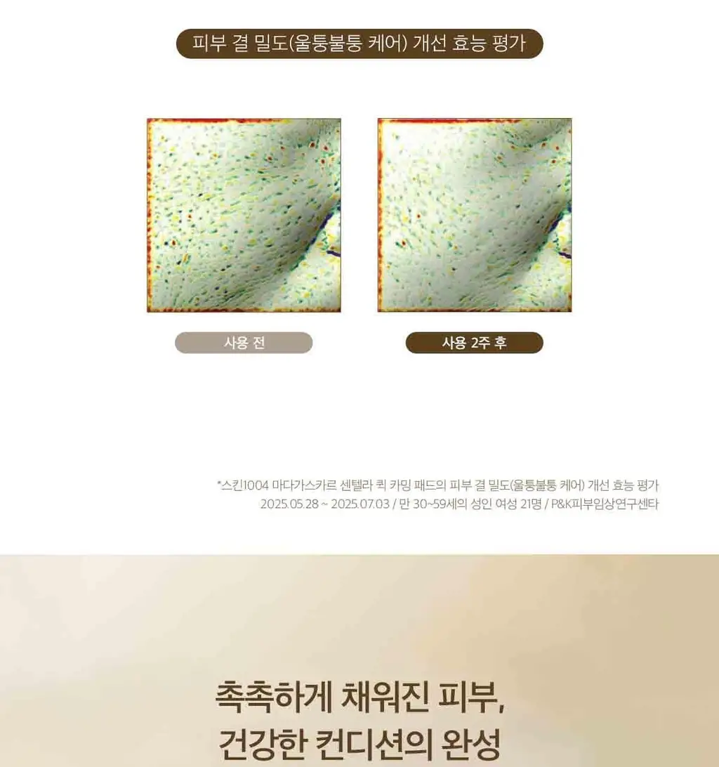 스킨1004 마다가스카르 센텔라 퀵카밍 패드 상세페이지 16