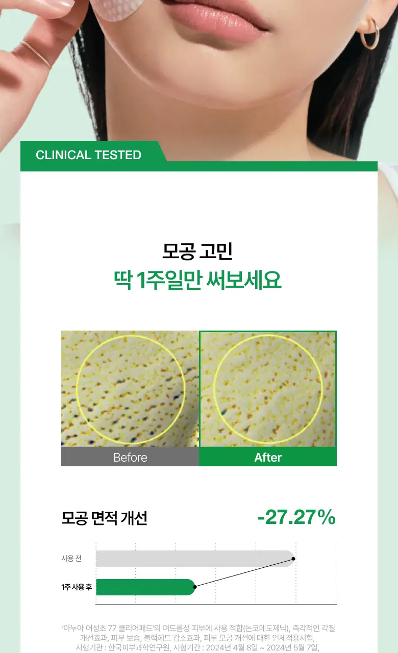 아누아 패드 4종 단품(어성초/피디알엔/카테킨/TXA) 상세페이지 10