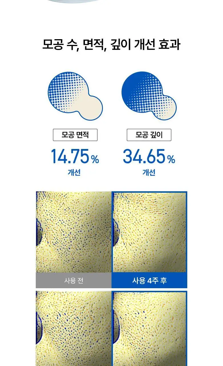 아누아 패드 4종 단품(어성초/피디알엔/카테킨/TXA) 상세페이지 70