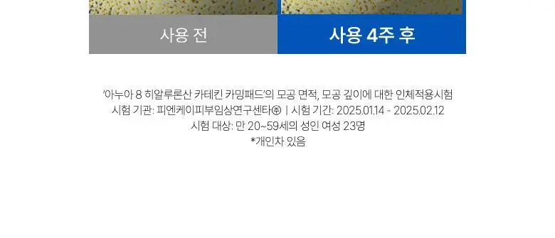 아누아 패드 4종 단품(어성초/피디알엔/카테킨/TXA) 상세페이지 71