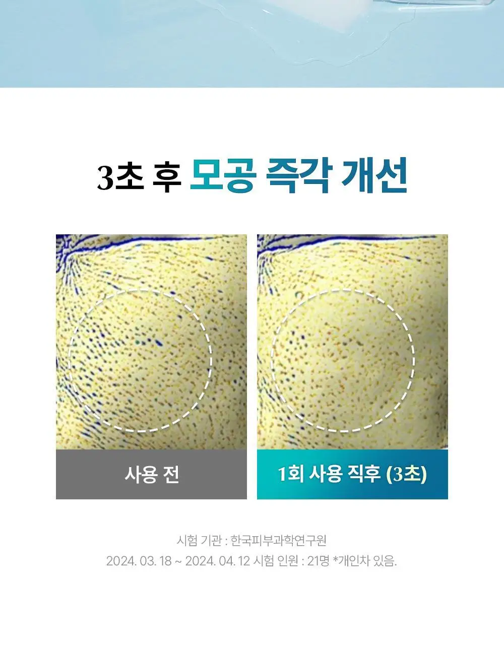 유이크 바이옴 레미디 포어리셋 쿨링패드 80매 상세페이지 16