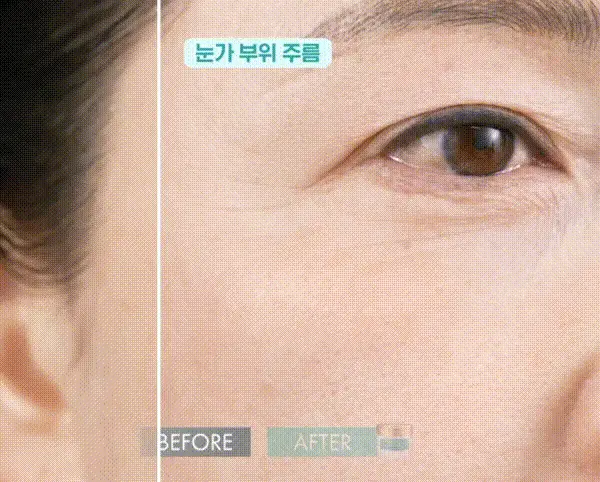 테라비코스 히알루론산 3000 링클 앰플 패드 60매 상세페이지 17