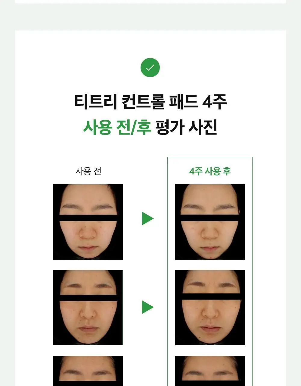 파파레서피 티트리 진정 컨트롤 패드 70매 상세페이지 8