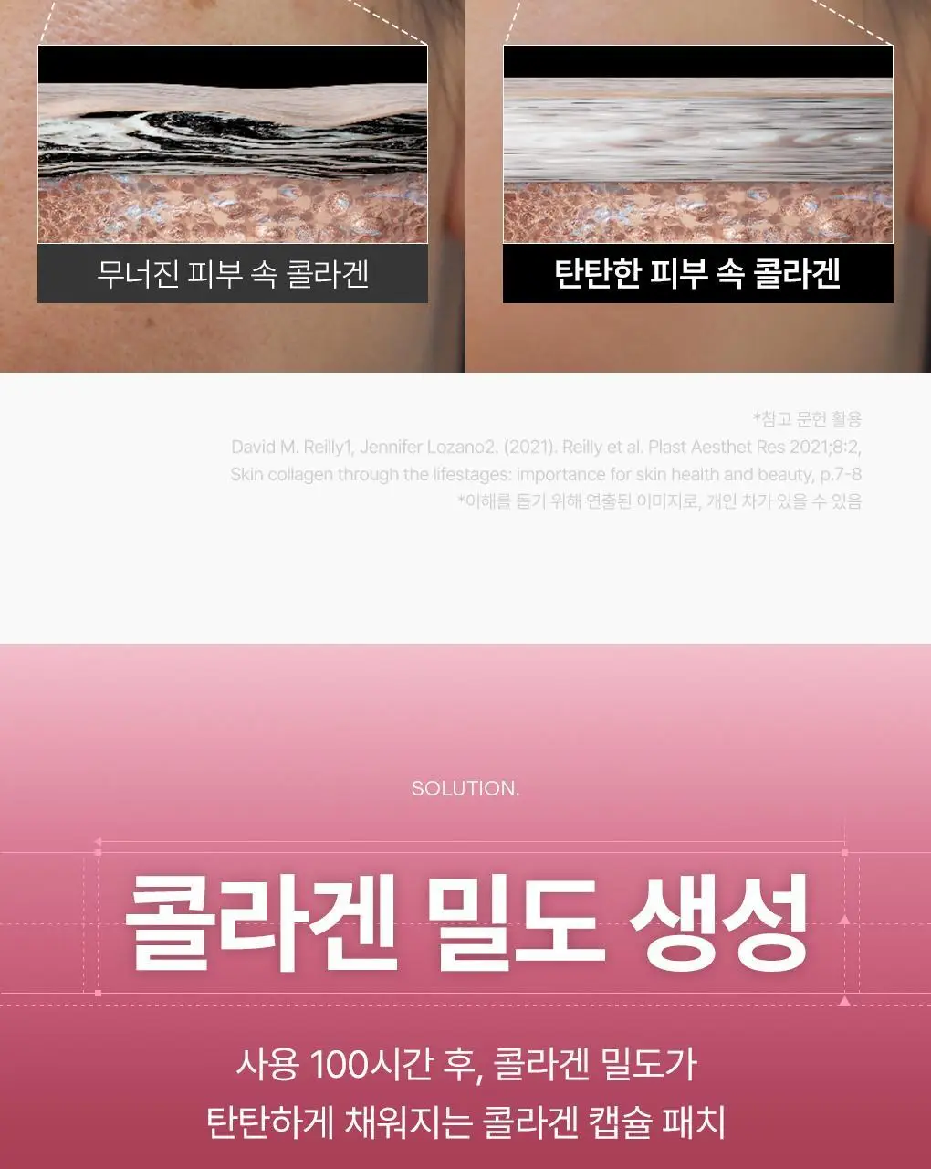 메디힐 콜라겐 캡슐 패치 60매 2종 (레티놀, 비타민C) 상세페이지 4