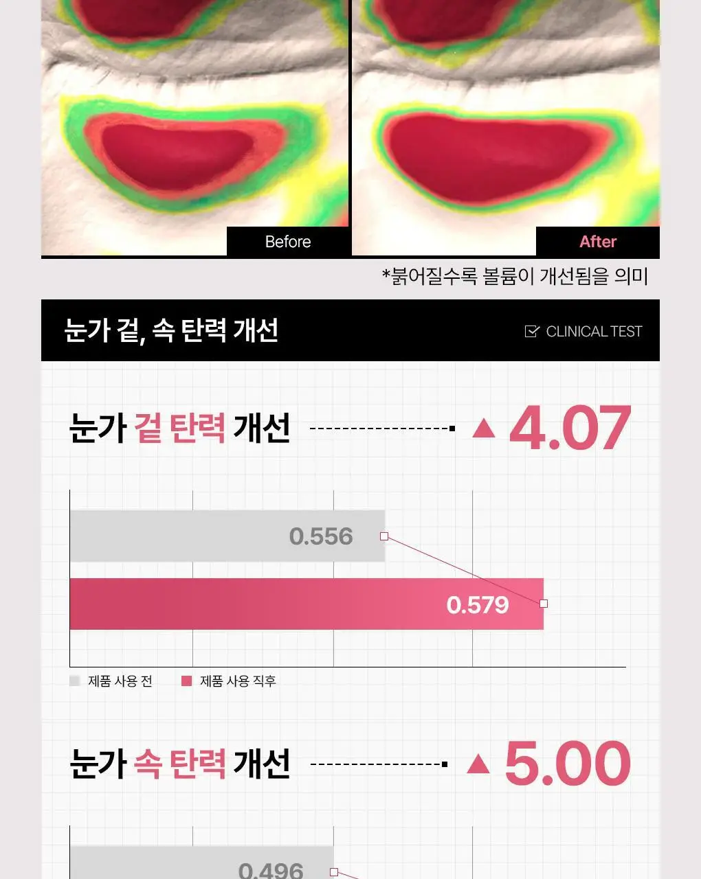 메디힐 콜라겐 캡슐 패치 60매 2종 (레티놀, 비타민C) 상세페이지 14