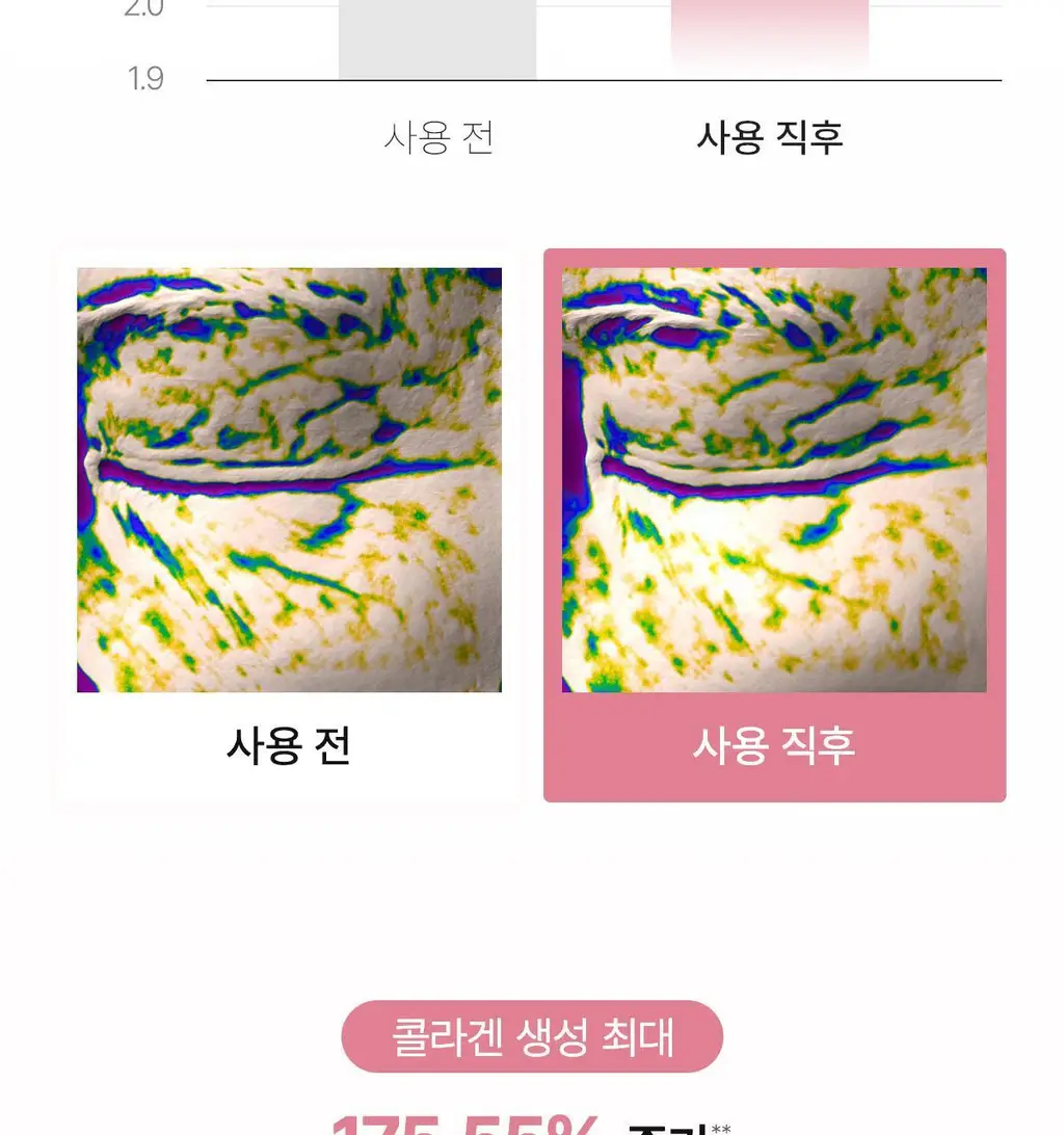 바이오던스 아이패치 60매 2종 택 1 (콜라겐/캐비어 PDRN) 상세페이지 12