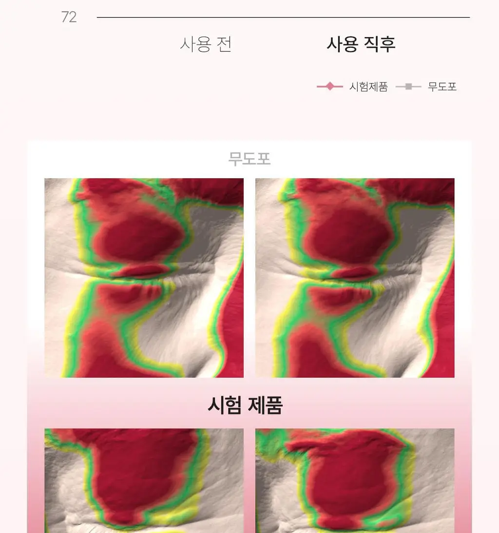 바이오던스 아이패치 60매 2종 택 1 (콜라겐/캐비어 PDRN) 상세페이지 15